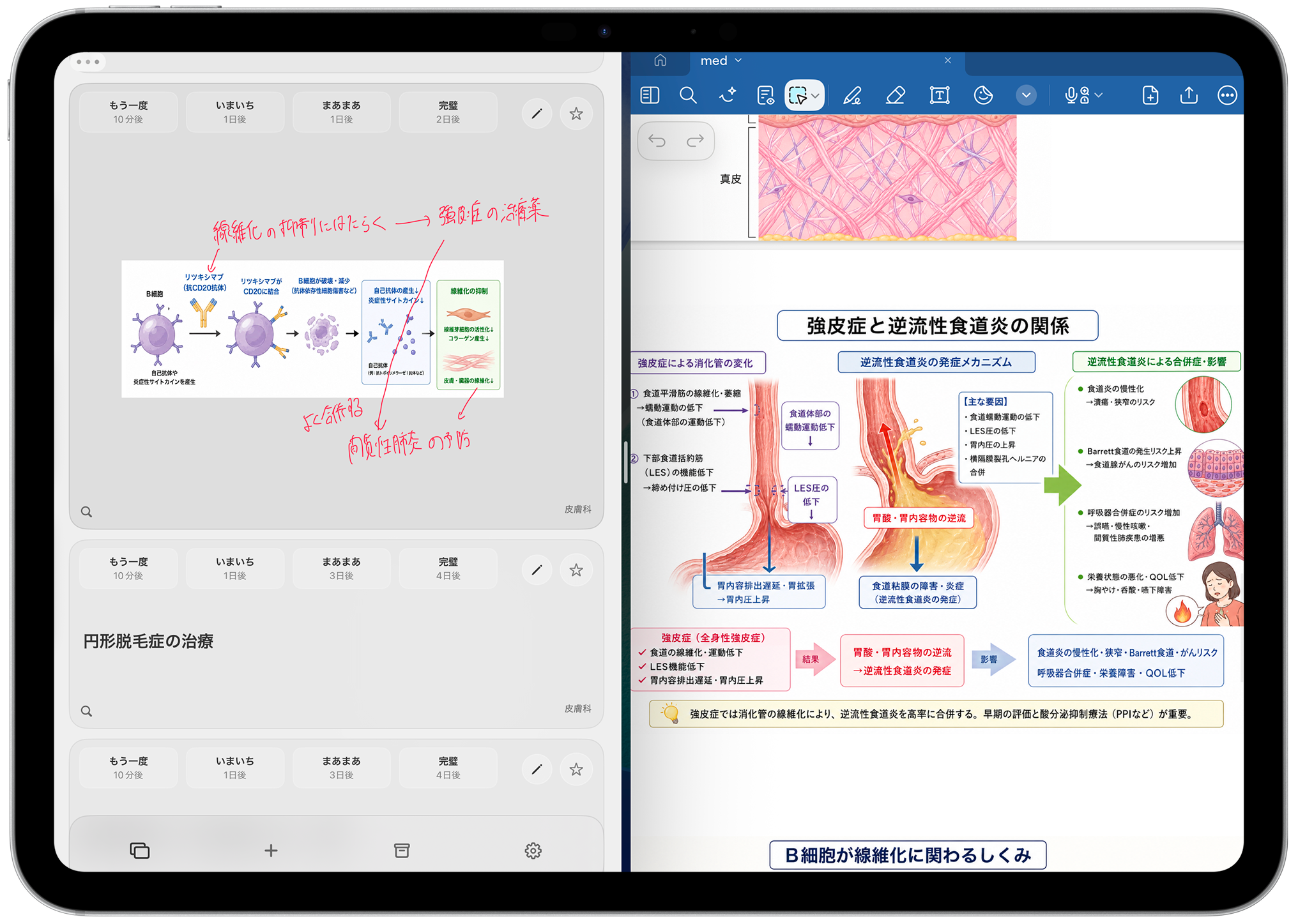ドラッグアンドドロップで素材を貼り付けるきおくまのiPad画面